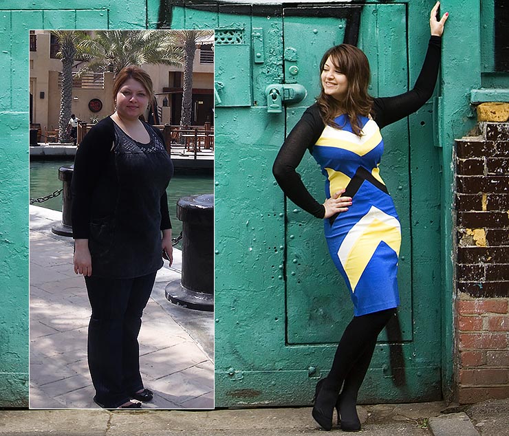 Hypnotherapy cured my Bulimia - I look and feel great